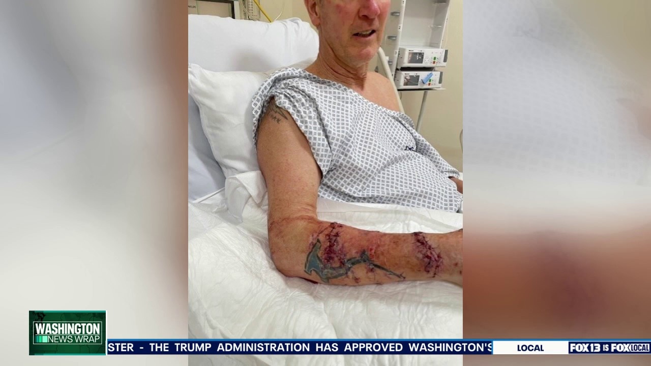 Richland man survives Crocodile attack on Mexico trip