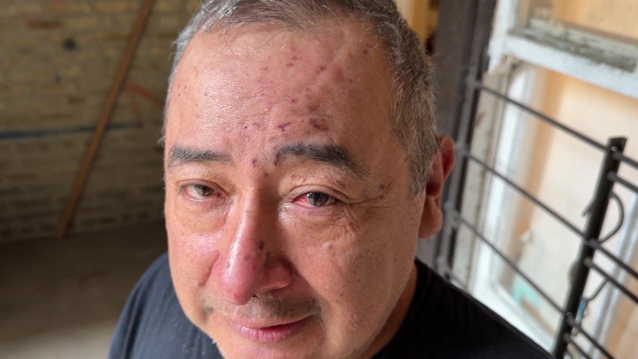 What he thought was a rat attack turned out to be something far more serious
