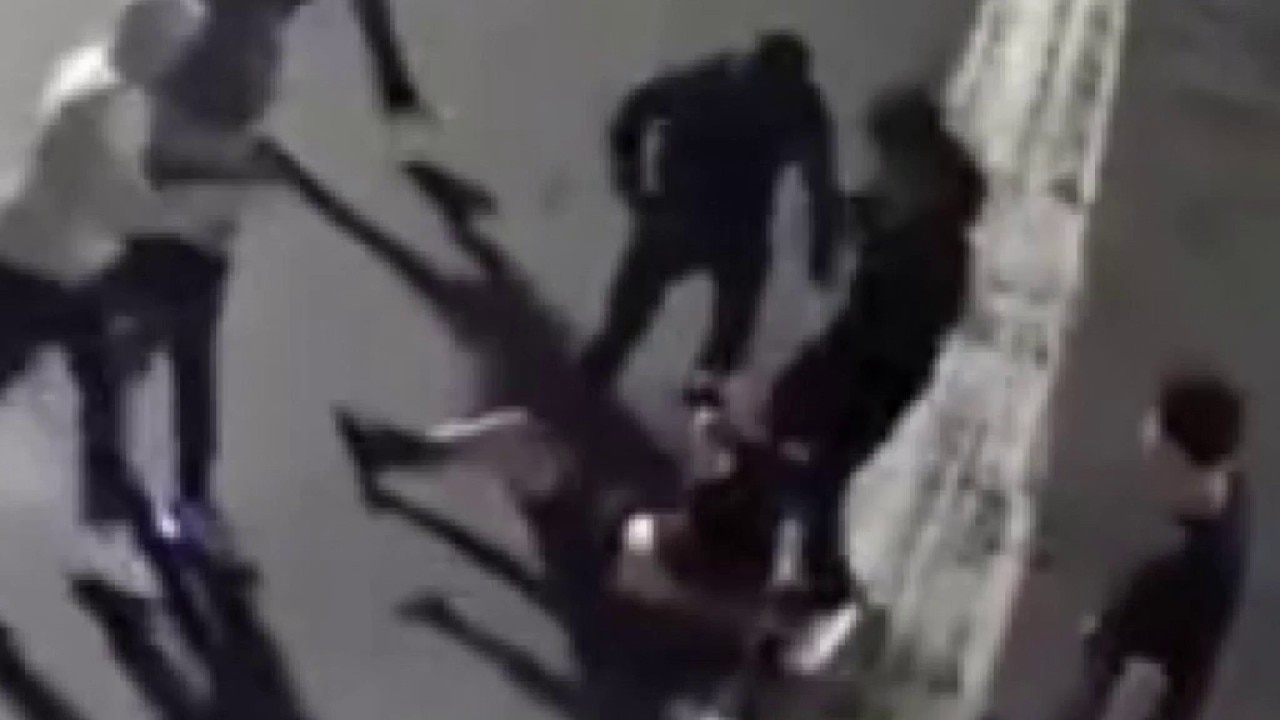 Man gets jumped over gold chain in Santa Ana