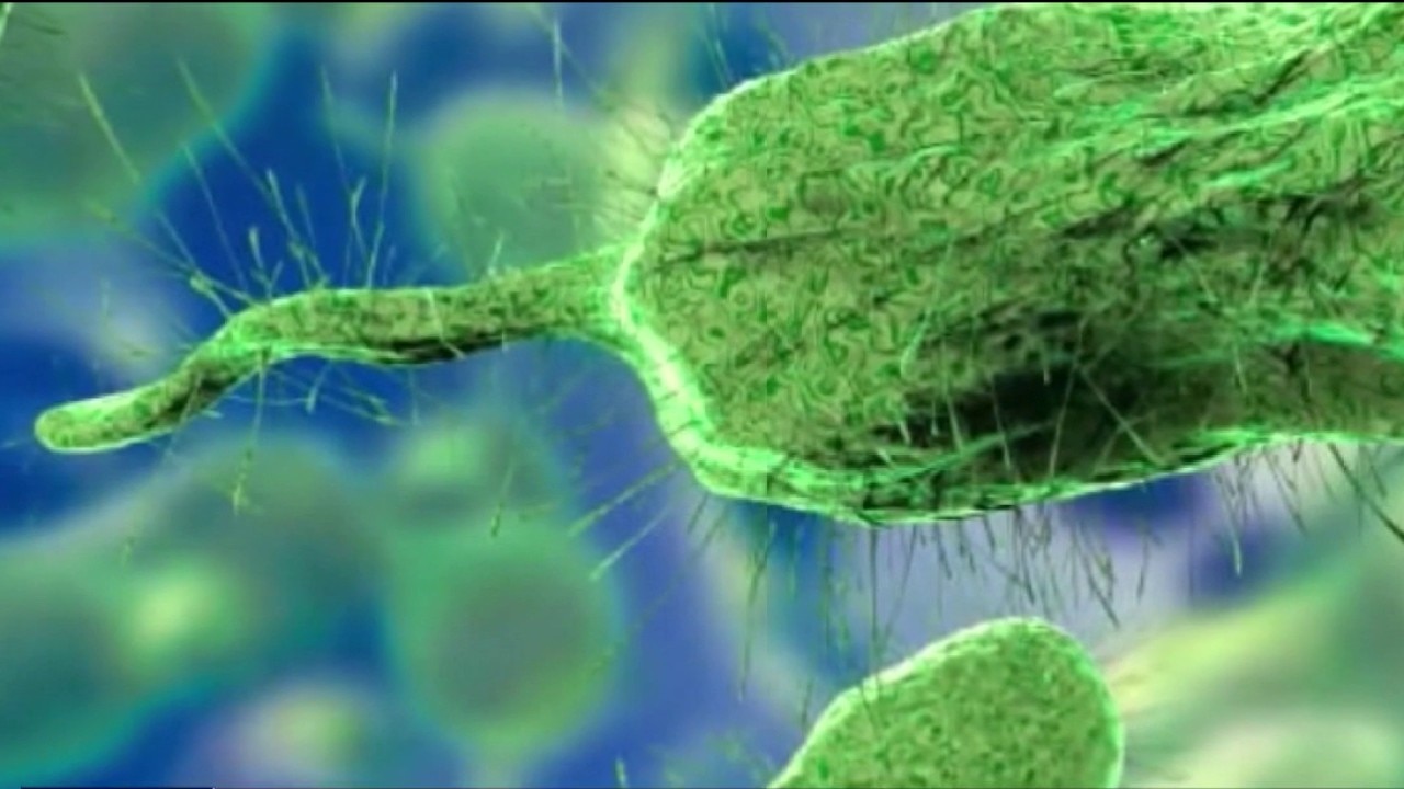 Pinellas resident dies from flesh-eating bacteria