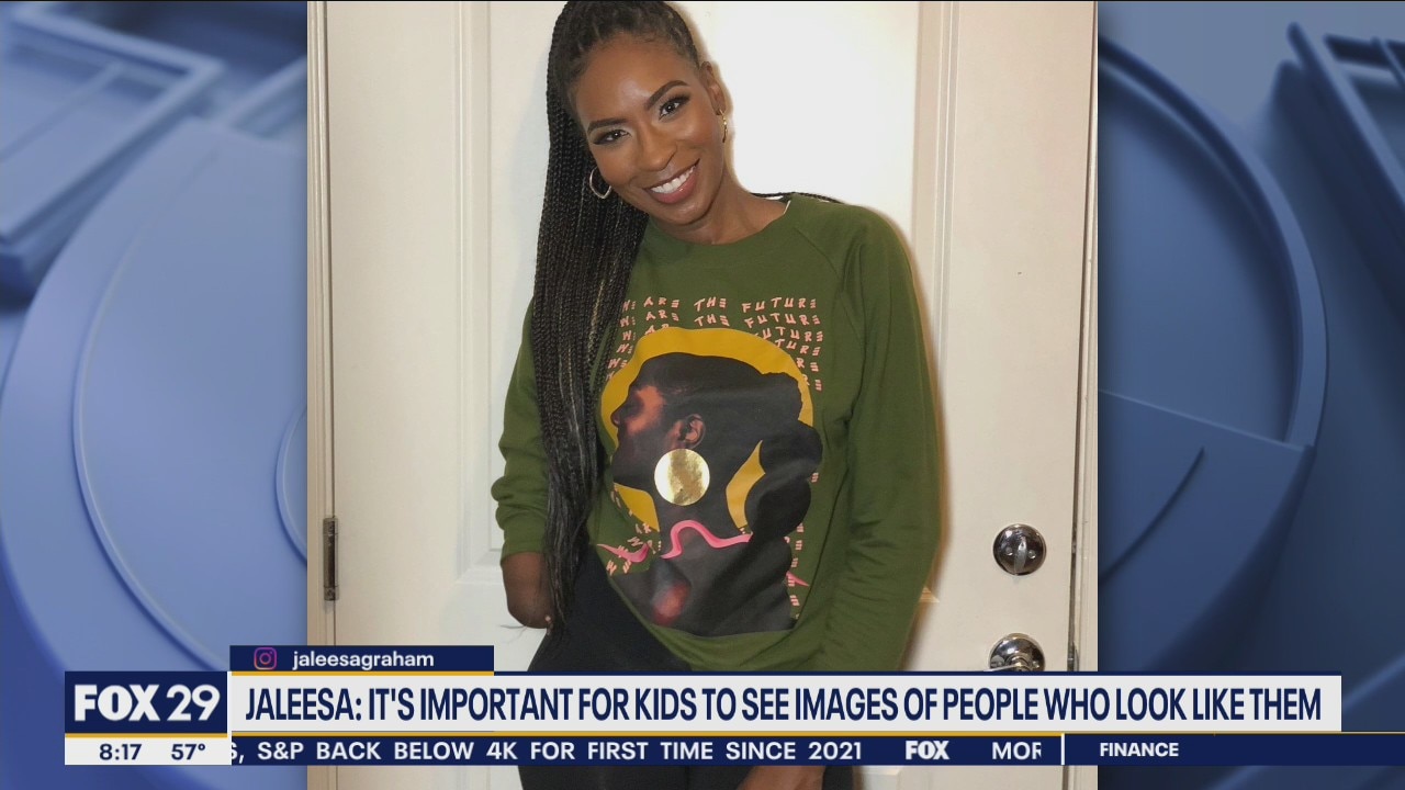 NJ mother, model talks importance of representation for people with limb differences
