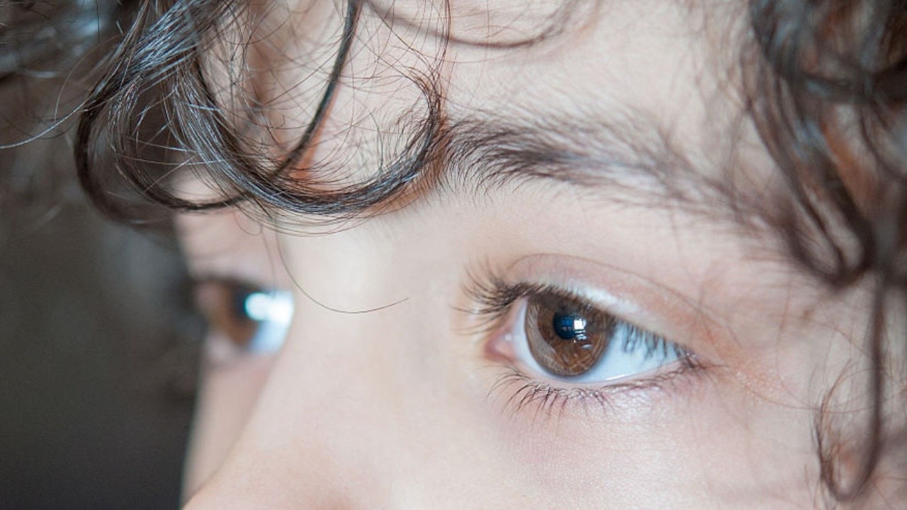 Vision loss and hallucinations: What to know about Charles Bonnet syndrome