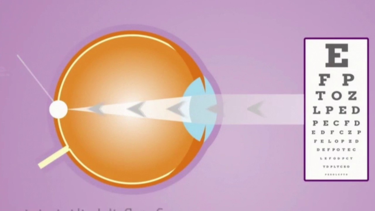 Childhood nearsightedness: Risks of myopia