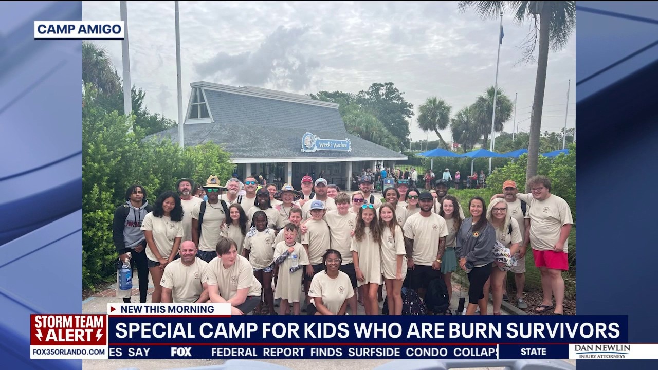From Healing to Prevention: Camp Helps Burn Survivors and Shares Safety Tips