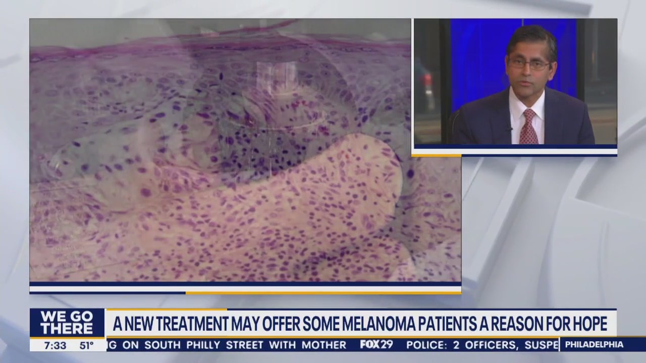 New treatment may offer some hope for melanoma patients