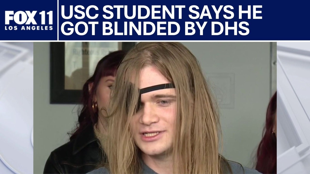 USC student hit in eye by DHS during 'No Kings' protest
