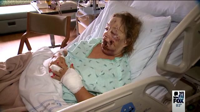 Dogs attack woman in Pierce County