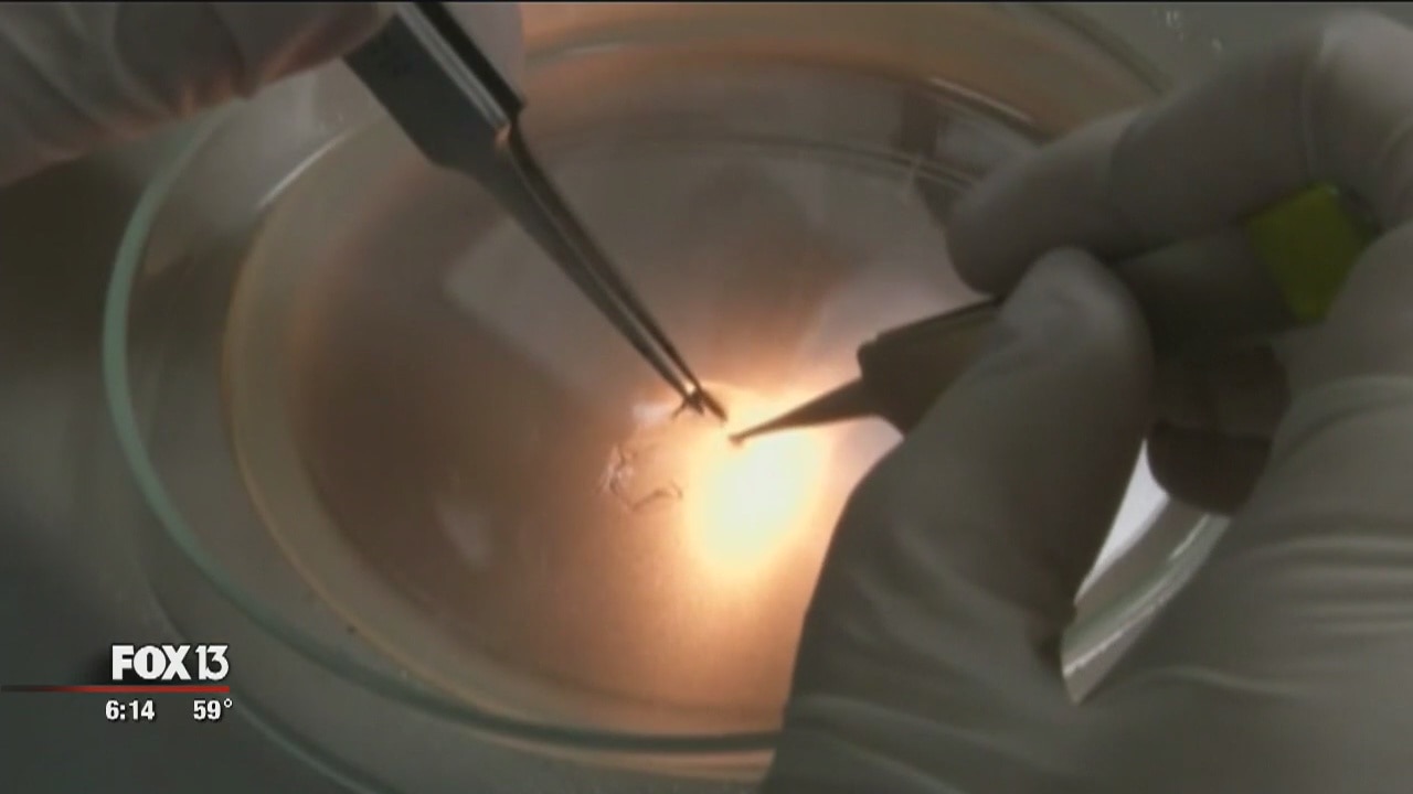 More Zika test kits arrive