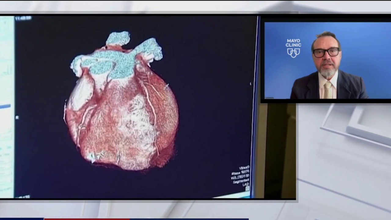 Heart Health: Fact vs. Fad