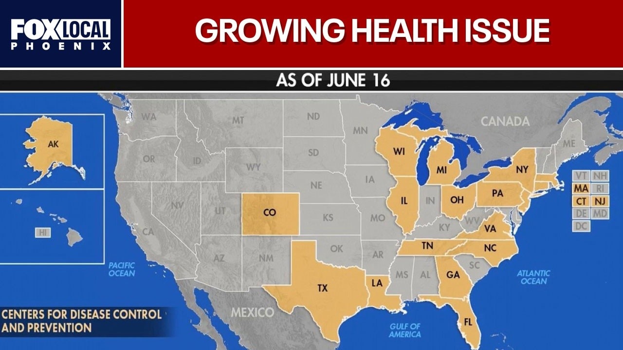 Cyclosporiasis outbreak spreads across US with nearly 1,000 cases