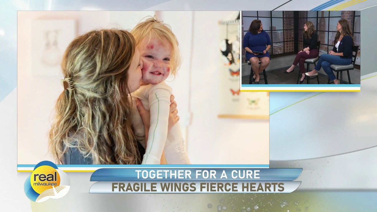 Tickets on sale and donations open for Fragile Wings Fierce Hearts: A Night for EB