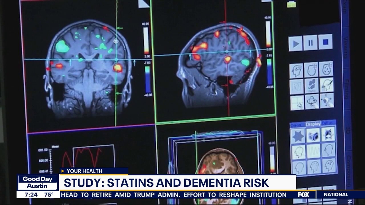 Statins & dementia risk | Health with Dr. Kumar