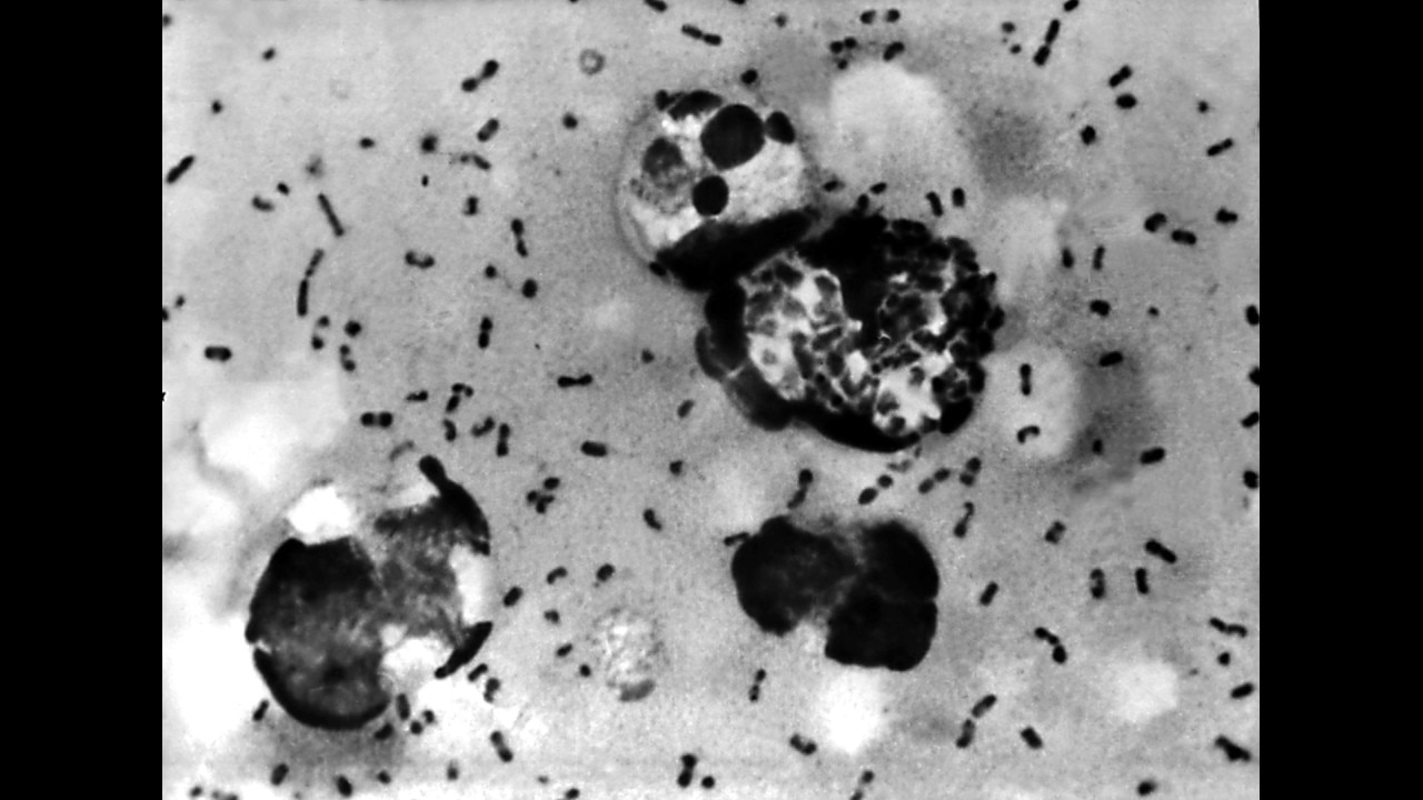 Suspected plague outbreak erupts in Russia after scientist dies