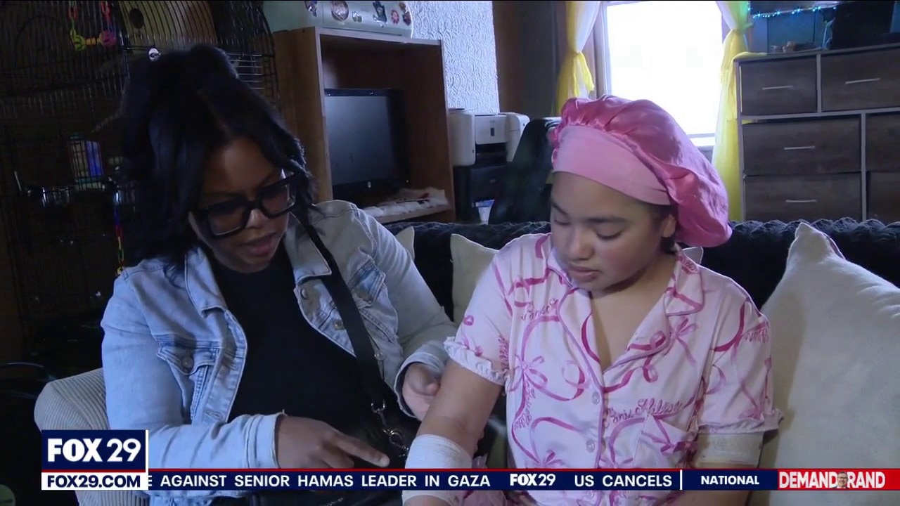 Mom speaks out after dog attacks her 2 children in Fairhill, Philadelphia