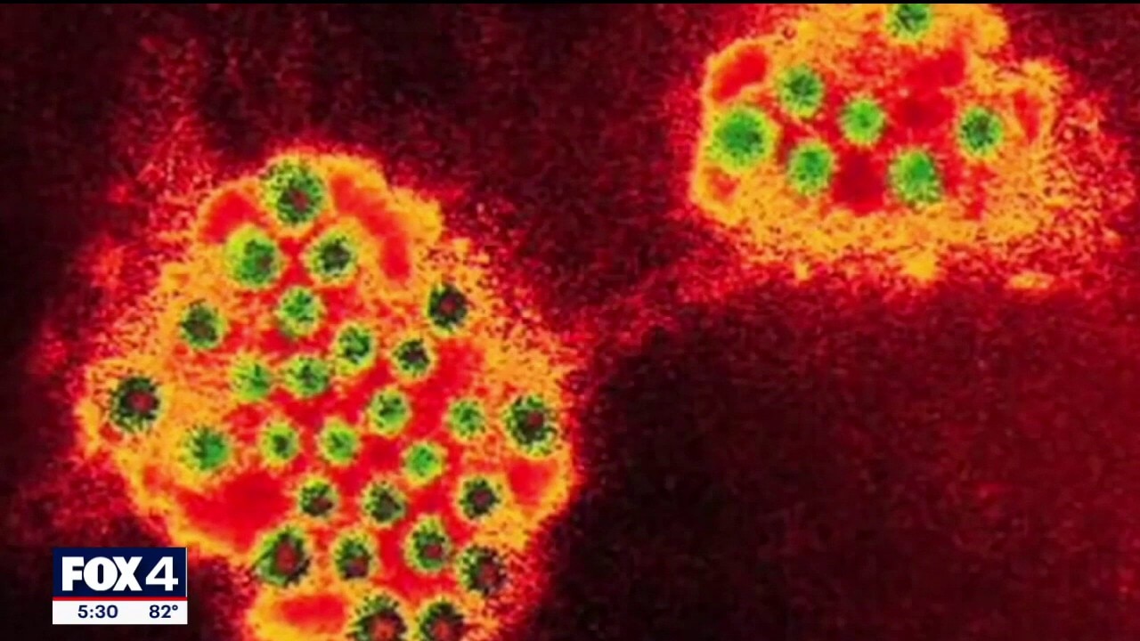 Pediatric flu cases spike earlier in North Texas this year