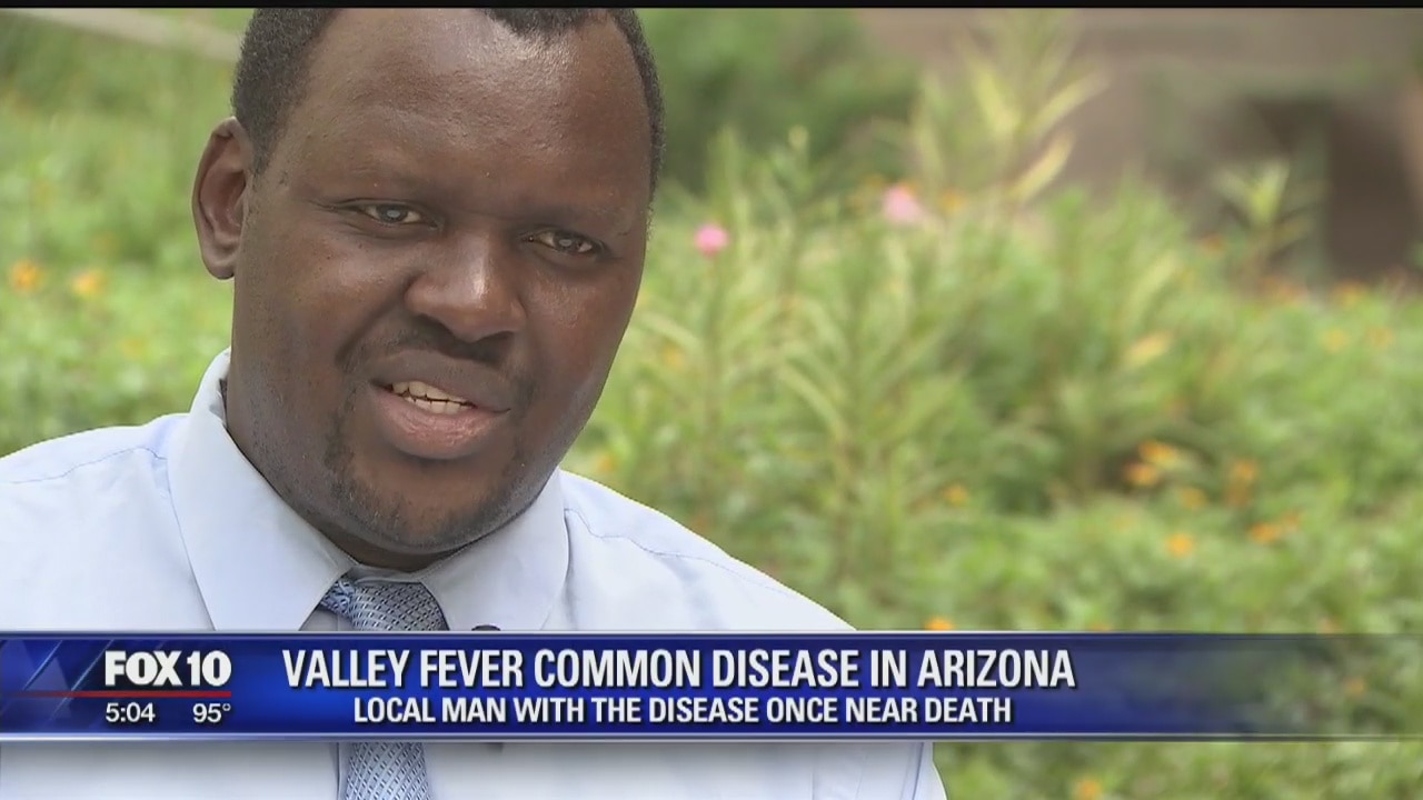 Man recounts his near-fatal experience with Valley Fever