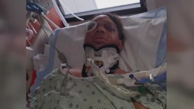 Milwaukee hit-and-run, 16th and Forest Home, motorcyclist on life support