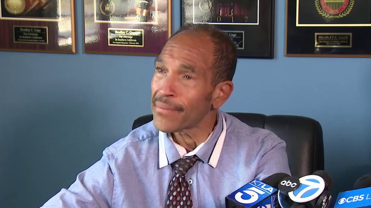 Man's face bloodied, hit with Taser by Burbank PD