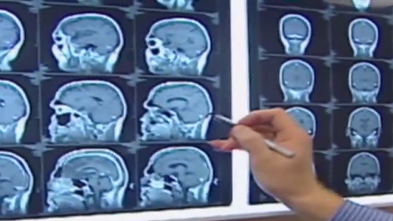 CHOA doctor breaks down youth sports concussion safety