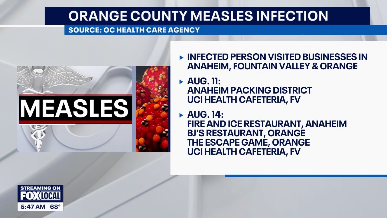 OC reports another measles infection