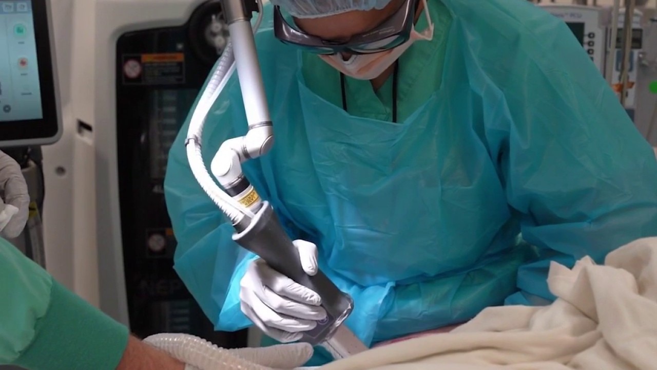 New Arizona Burn Center laser technology