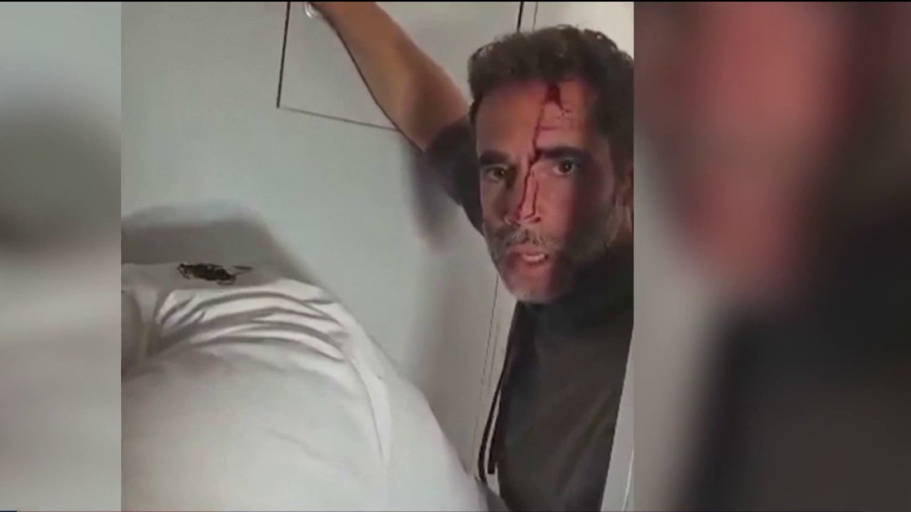 Disaster averted: Pilot stabbed on Israel flight