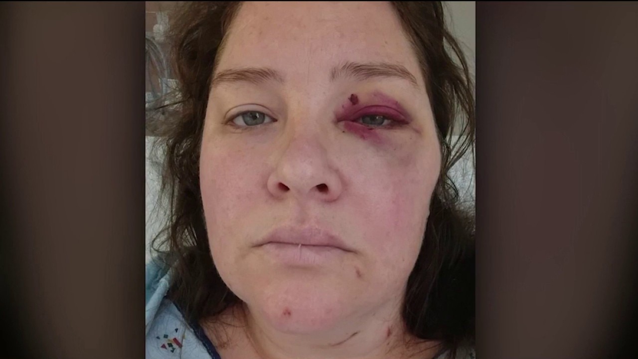 Cherokee County survivor details violent attack
