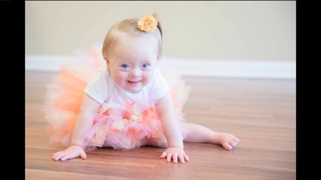World Down Syndrome Day