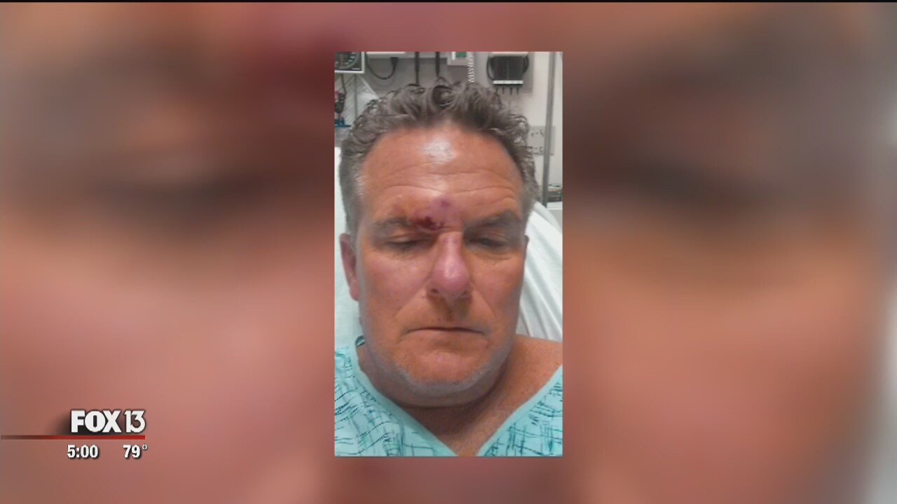 Man claims assault was prompted by Trump sticker
