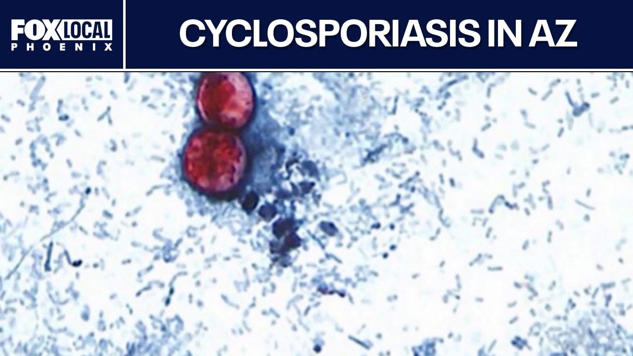 Arizona parasitic illness cases linked to fresh produce