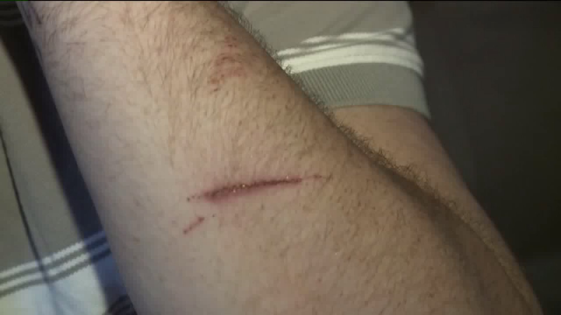 Man says he was cut with knife at anti-Sharia rally