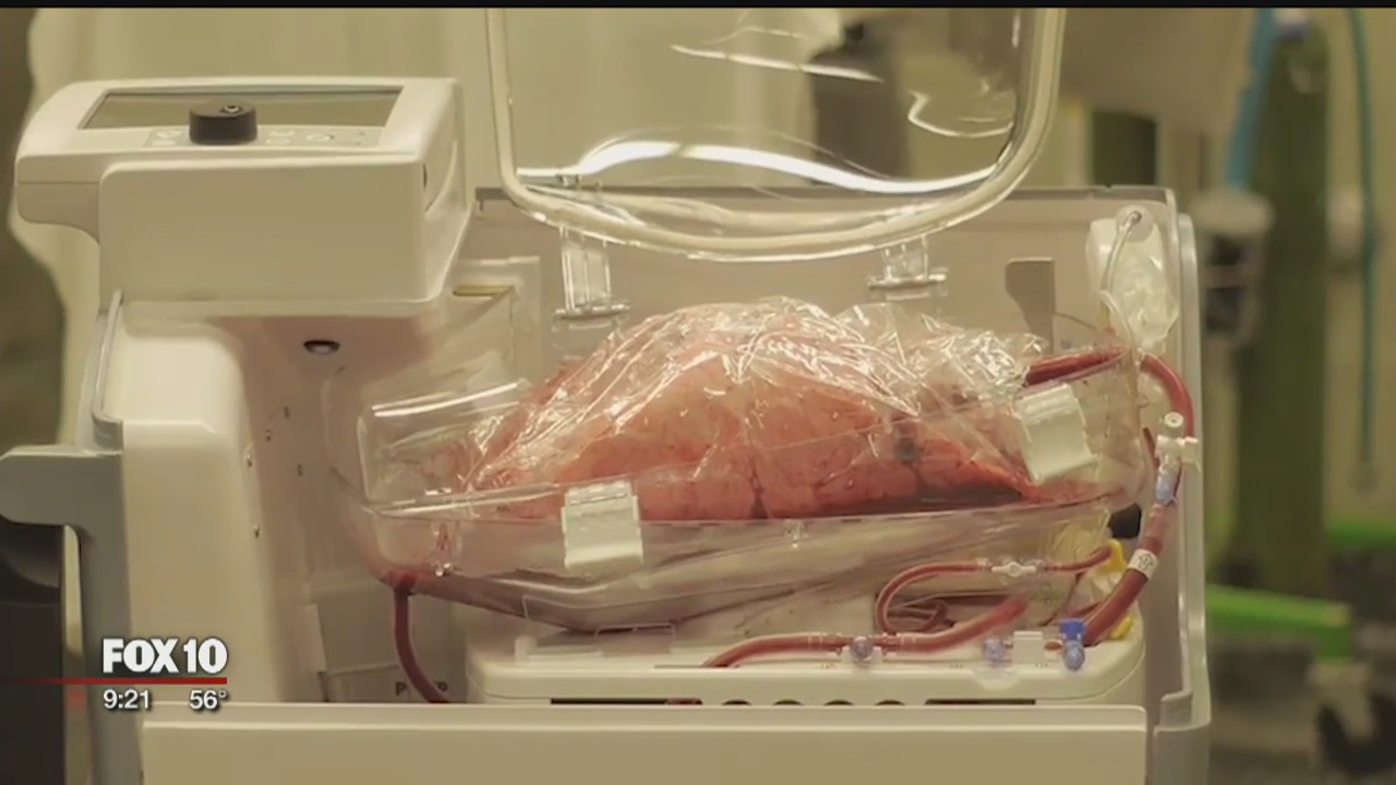 Lungs in a box: Game-changer for transplants