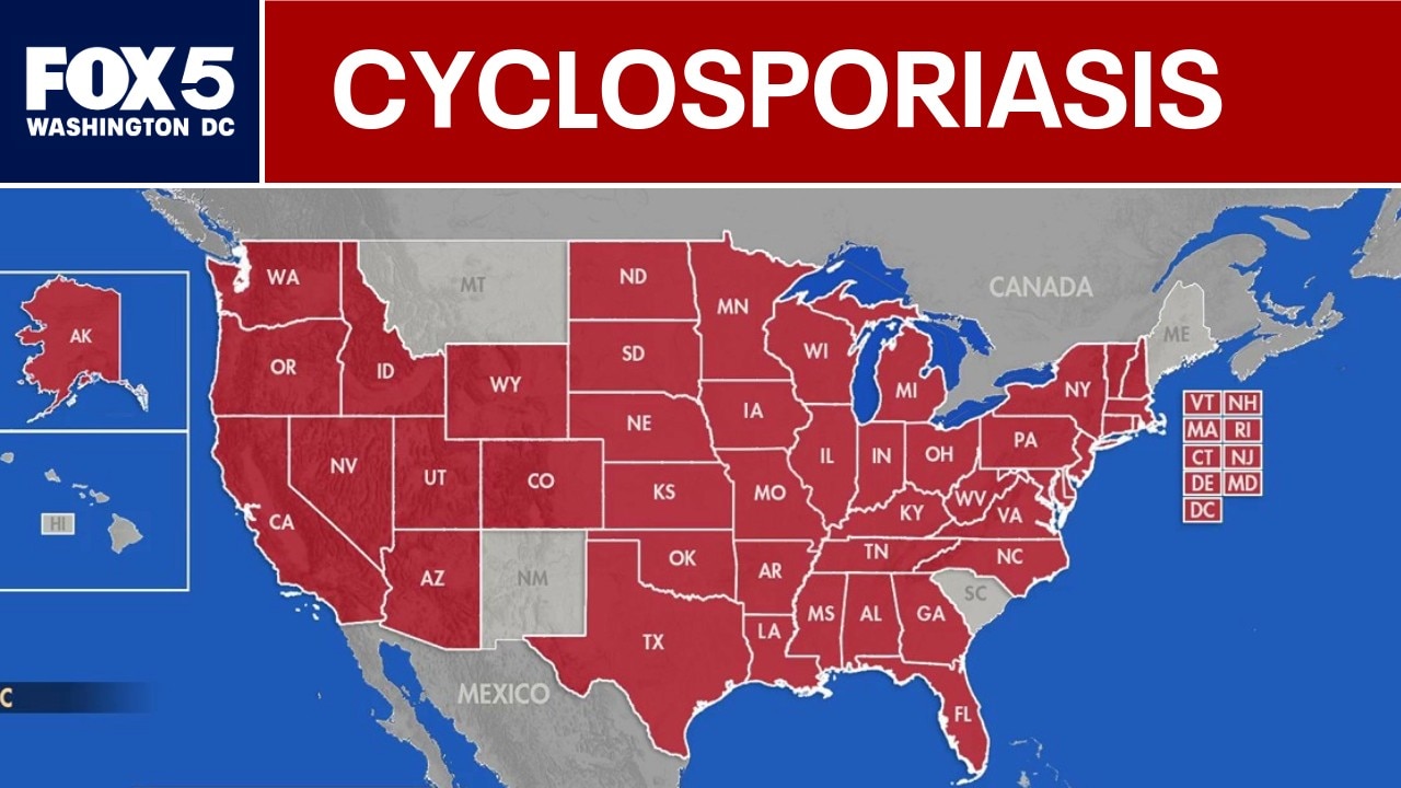 18,000 cyclospora cases suspected in U.S. 