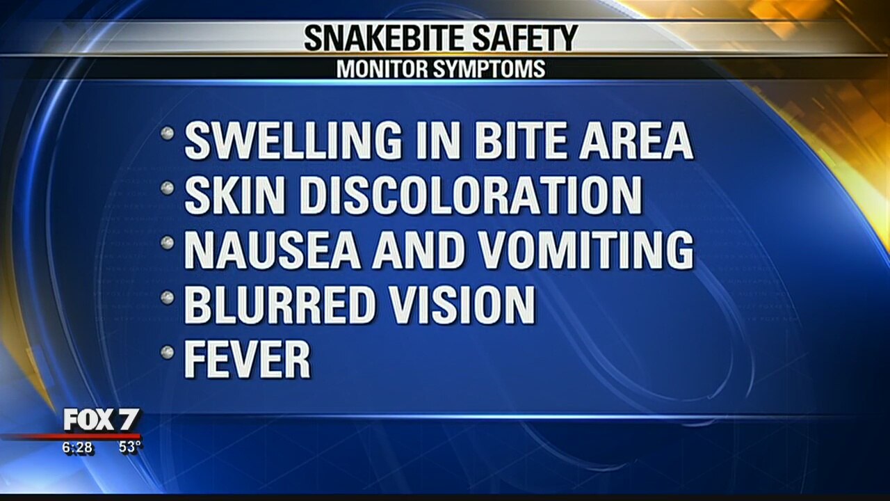 Doctors prepare to treat snakebites as sightings increase