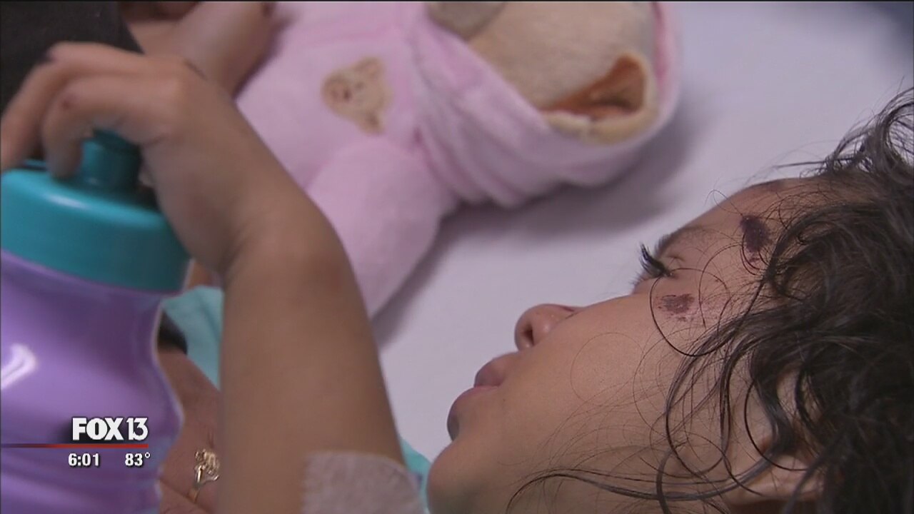 3-year-old recovering after hit-and-run