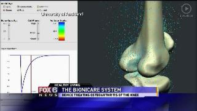 Bionic Knee Doctor
